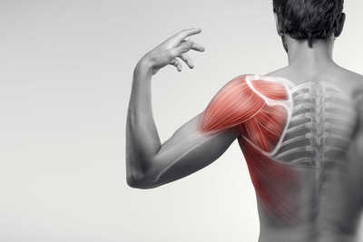 Shoulder Pain Impingement