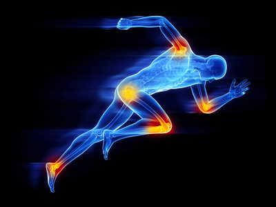 Sports Injuries